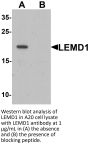 LEMD1 Antibody