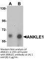 ANKLE1 Antibody