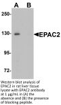 EPAC2 Antibody