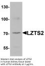LZTS2 Antibody