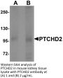 PTCHD2 Antibody