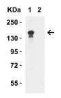 JMJD3 Antibody