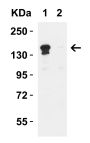 JMJD3 Antibody