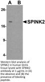 SPINK2 Antibody