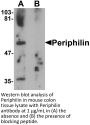Periphilin Antibody