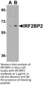 IRF2BP2 Antibody