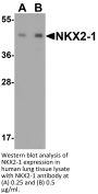 NKX2-1 Antibody