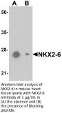 NKX2-6 Antibody