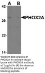 PHOX2A Antibody