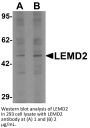 LEMD2 Antibody