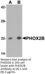 PHOX2B Antibody