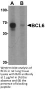 BCL6 Antibody