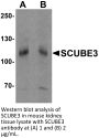 SCUBE3 Antibody
