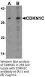CDKN1C Antibody