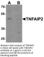 TNFAIP2 Peptide