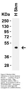 LMX1A Antibody