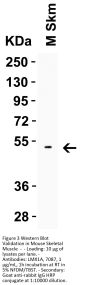 LMX1A Antibody