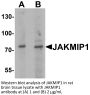 JAKMIP1 Antibody