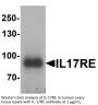 IL-17RE Antibody