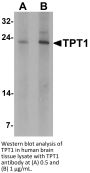 TPT1 Antibody