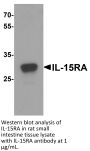 IL-15RA Antibody