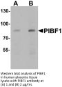 PIBF1 Antibody