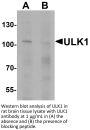 ULK1 Antibody
