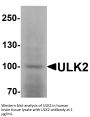 ULK2 Antibody