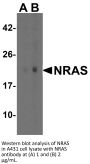 N-RAS Antibody