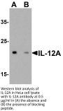 IL-12A Antibody