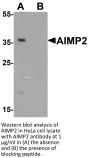 AIMP2 Antibody