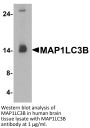 MAP1LC3B Antibody
