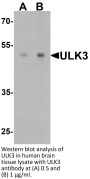ULK3 Antibody