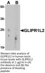 GLIPR1L2 Antibody