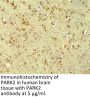 PARK2 Antibody