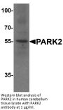 PARK2 Antibody