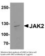 JAK2 Antibody