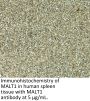 MALT1 Antibody