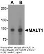 MALT1 Antibody