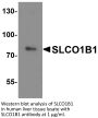 SLCO1B1 Antibody