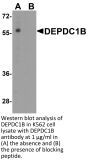 DEPDC1B Antibody