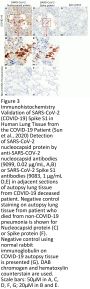 SARS-CoV-2 (COVID-19) Spike S1 Antibody