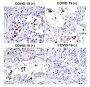 SARS-CoV-2 (COVID-19) Spike S1 Antibody