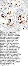 SARS-CoV-2 (COVID-19) Spike S1 Antibody