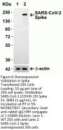 SARS-CoV-2 (COVID-19) Spike S1 Antibody