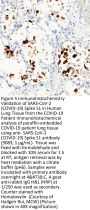 SARS-CoV-2 (COVID-19) Spike S1 Antibody