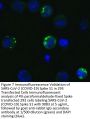SARS-CoV-2 (COVID-19) Spike S1 Antibody