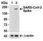 SARS-CoV-2 (COVID-19) Spike RBD Antibody