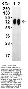 SARS-CoV-2 (COVID-19) Spike RBD Antibody