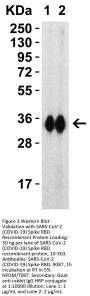 SARS-CoV-2 (COVID-19) Spike RBD Antibody